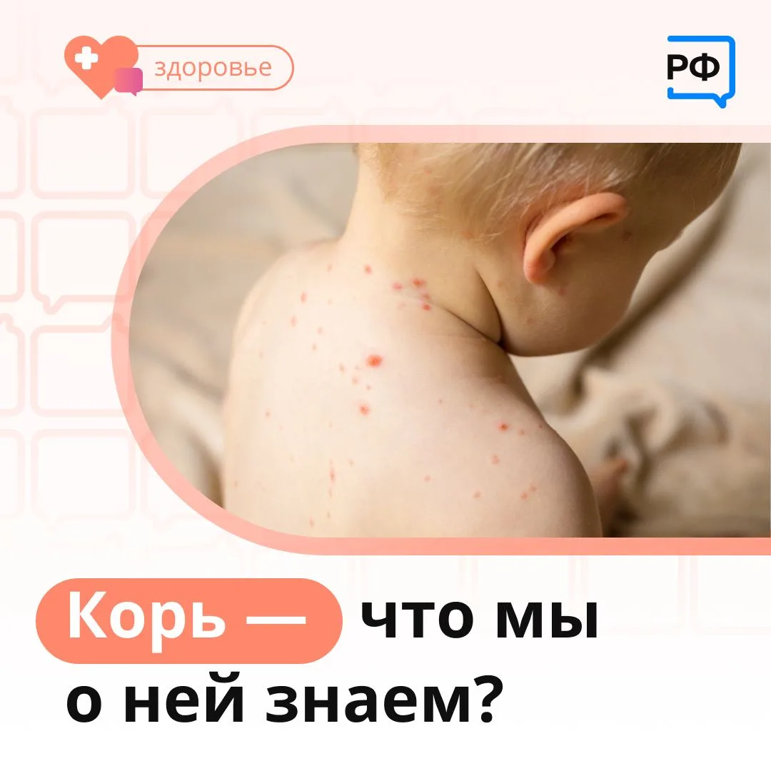 Корь, краснуха, паротит, полиомиелит — эти инфекции опасны не только сами по себе, но и тяжёлыми последствиями, которые могут повлиять на здоровье на всю жизнь